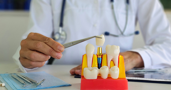 Dental implants vs Dentures - Which option is right for you